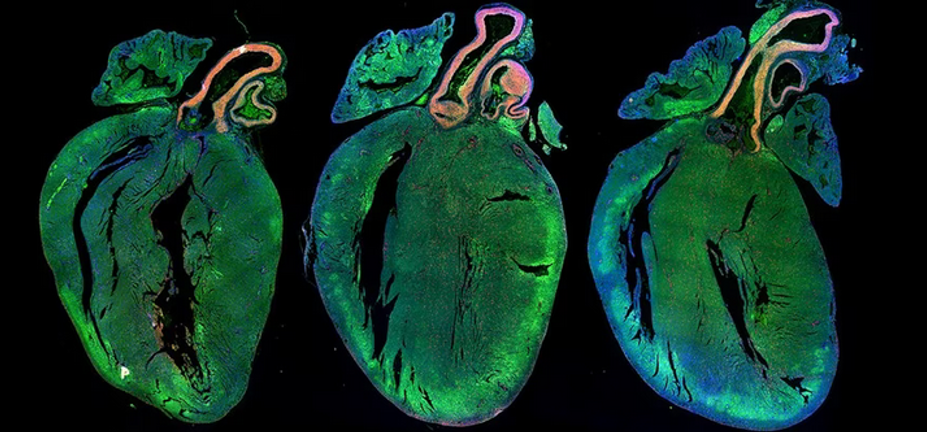 بهبود قلب آسیب دیده با پزشکی باز‌ساختی